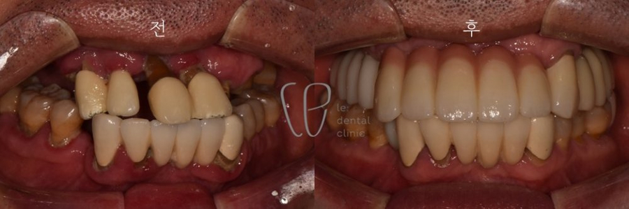 Slider image (2) Le Dental Clinic